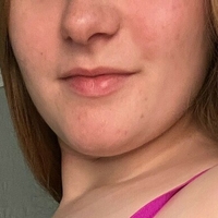 freepennypurge Desnuda