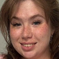 sunnyfoxy Desnuda